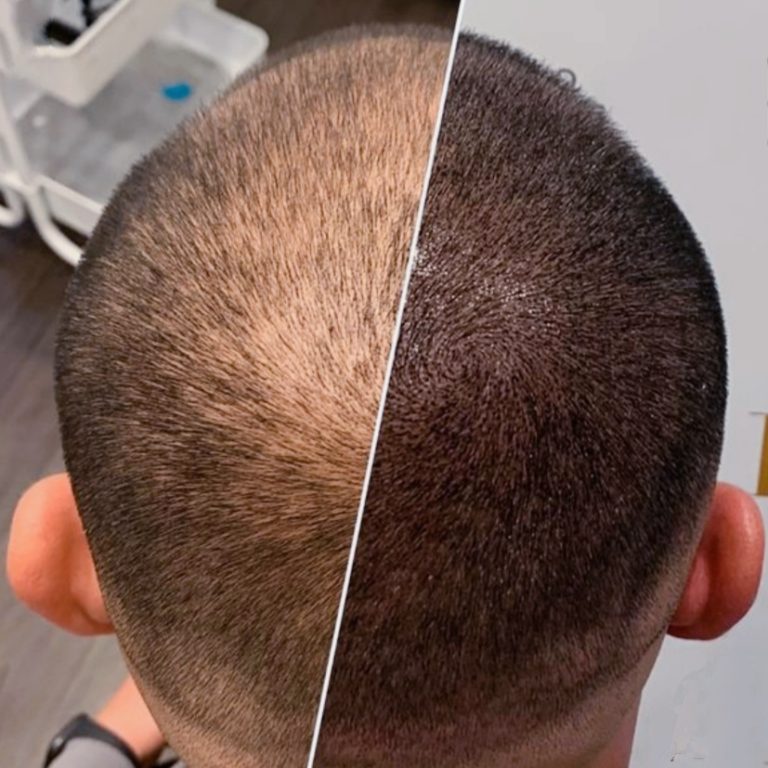 67940e166a257-img-20250124-170946