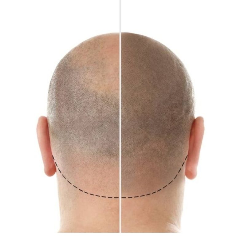 67942018e2931-img-20250124-164208