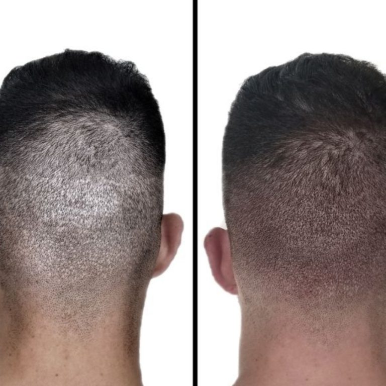 6797fa778c800-img-20250126-205515 (1)