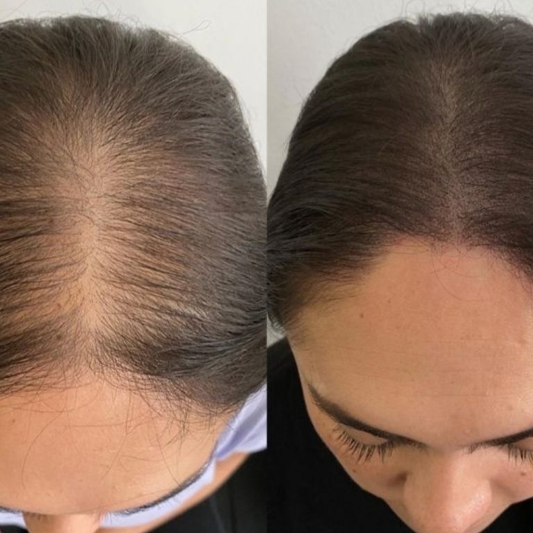 6797fd92ecb09-img-20250124-235148